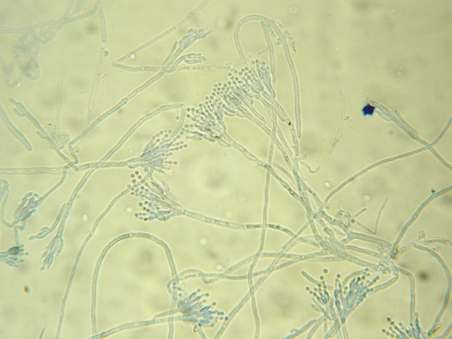 ペニシリウムの不思議な世界：カビの王国の秘密に迫る！