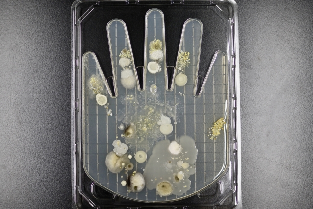 テレビ・メディア取材について：カビ問題の見える化と解決法