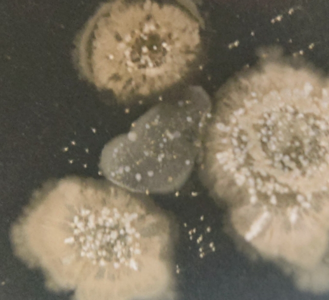 カビ集団が家庭にもたらす危険とその簡単な解決策