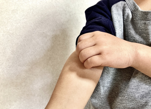 アトピー患者必見！知っておきたいカビの種類とその影響