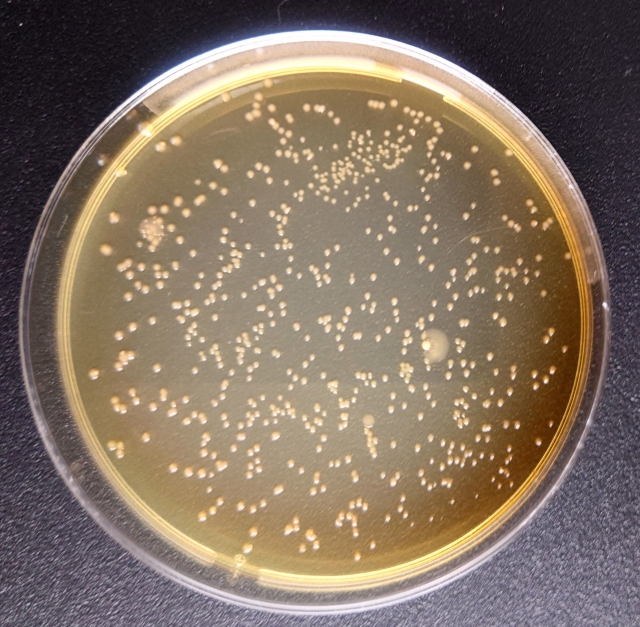 カビとウイルスの違いと健康への影響：家庭での効果的な管理法まで徹底解説
