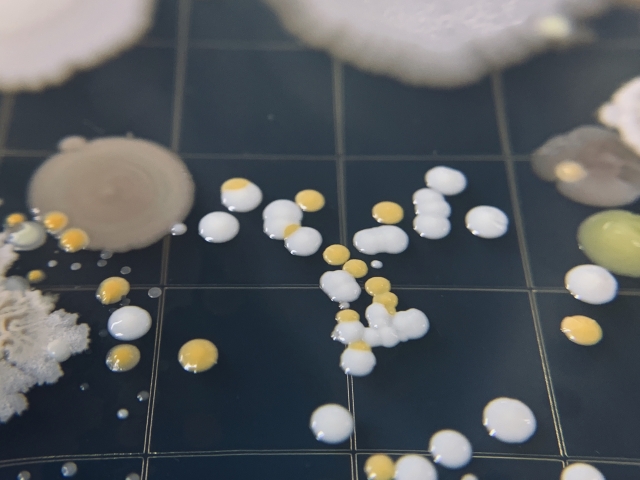 知らないと損！カビコロニーの形成から健康リスクまで徹底解説