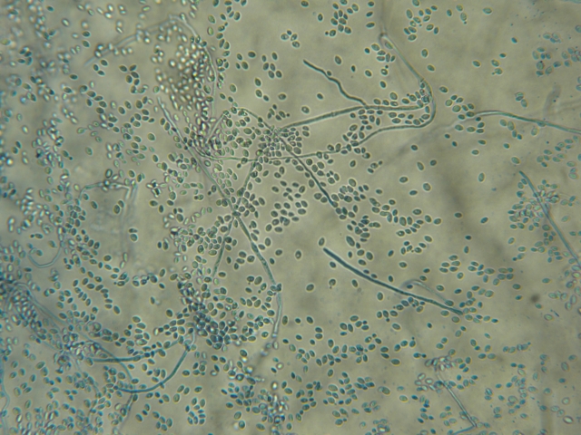 緑色のカビが発生する理由と自宅でできるベスト対策方法