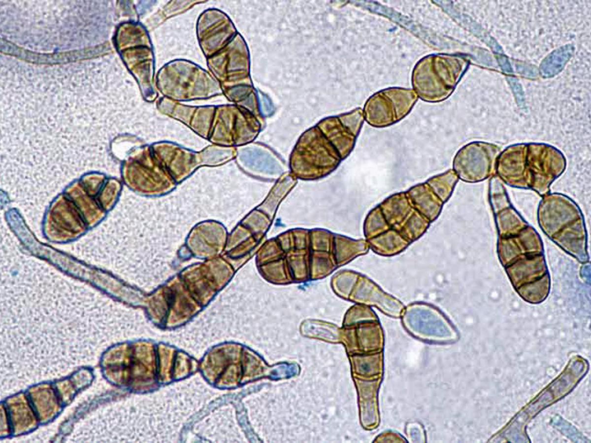 浴室にひそむ黒い影！？アルテルナリア（ススカビ）の特徴と私たちにできる