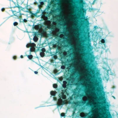 【要注意】Aspergillus（アスペルギルス／コウジカビ類）って何