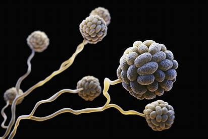 【黒色有毒カビ】Stachybotrys chartarum（スタキボ