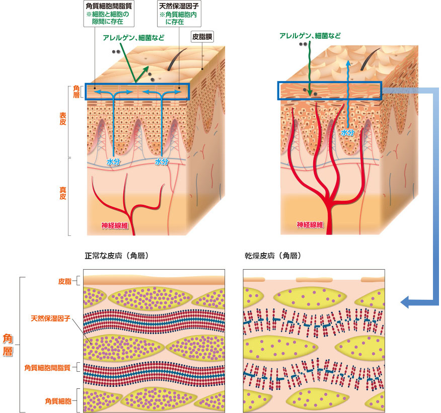 アトピー性皮膚炎とカビの深い関係